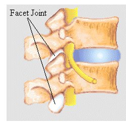 lumbar-facet-joint-pain